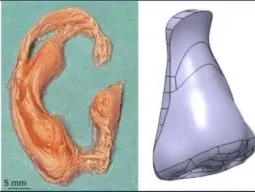 Direct Sound Printing - Forscher wollen 3D-Implantate ohne Operation im Körper drucken 3